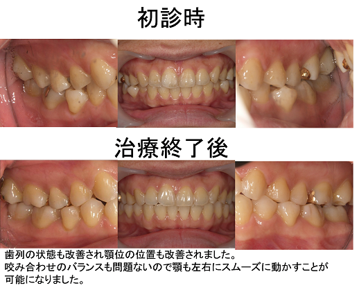 図12