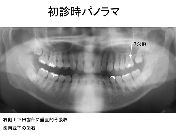 図1