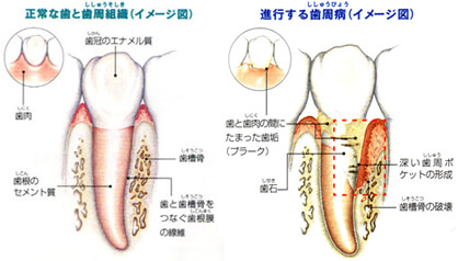 赤坂デンタルオフィスの歯周外科