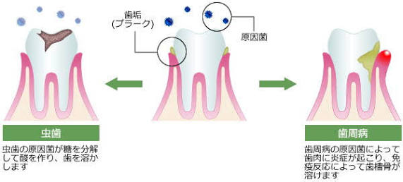 自由ヶ丘デンタルスタジオの予防歯科